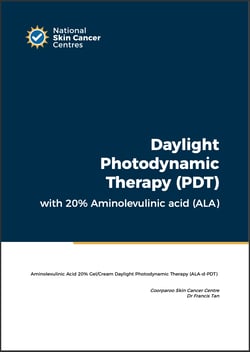 NSCC Clinical Guideline - Daylight PDT