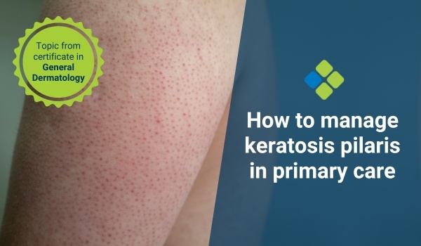 can glutathione help keratosis pilaris Can Glutathione Help Keratosis Pilaris? Understanding the Connection main image 0